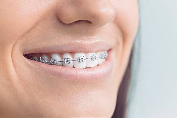 Best Invisalign and Clear Aligners  in Liberty Lake, WA